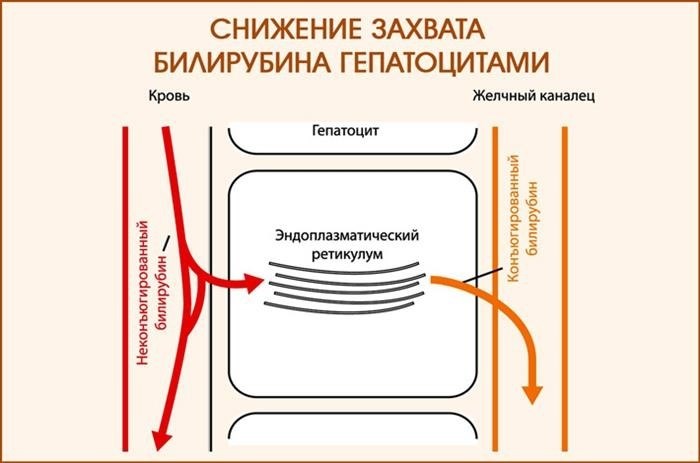 Парк жильбера. Жильбера схема. Синдром Жильбера наследование.